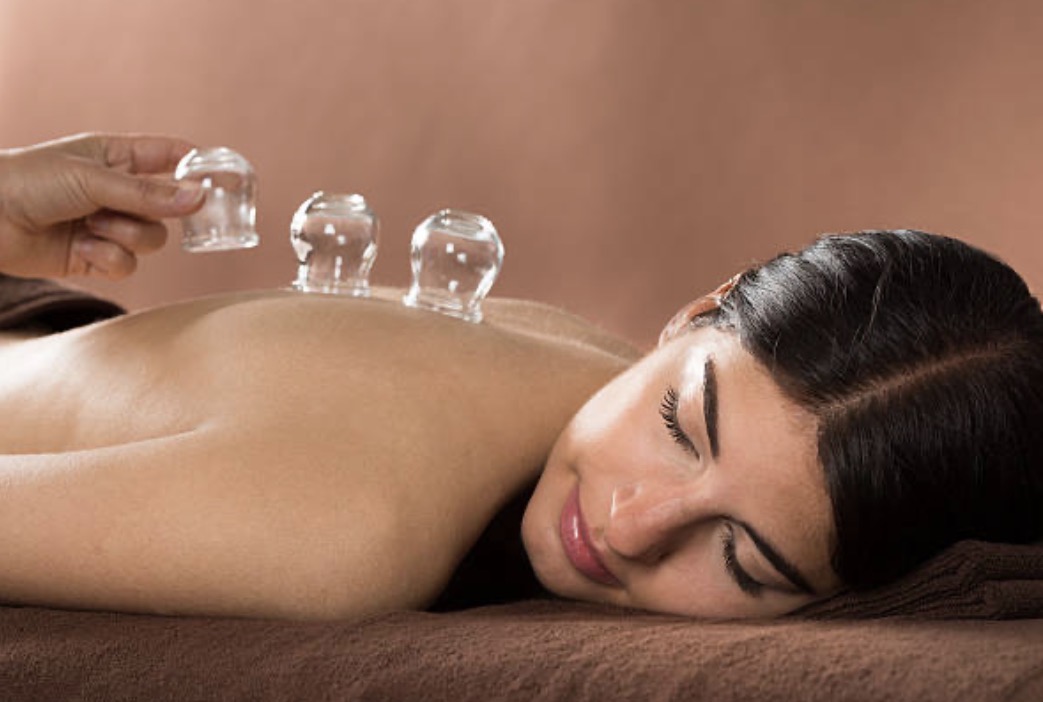 ventouses et cupping en osteopathie